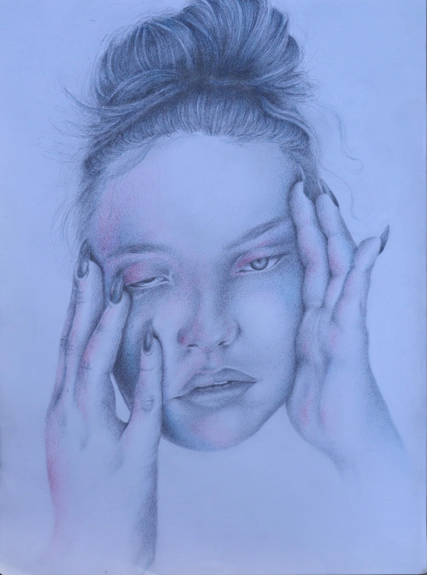 Chronic Fatigue
